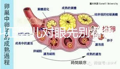 糾正嬰兒對眼先別著急，眼科醫生教你3招鑒別法