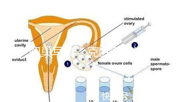 卵巢早衰，克齡蒙和芬嗎通藥物選擇引爭(zhēng)議