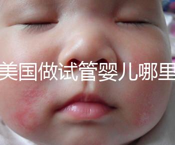 去美國做試管嬰兒哪里最好,4家好評輔助生殖機構(gòu)推薦