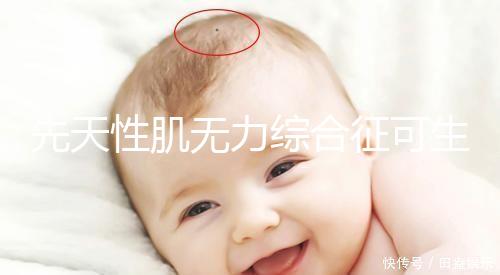 先天性肌無(wú)力綜合征可生育嗎？能做試管避免遺傳？