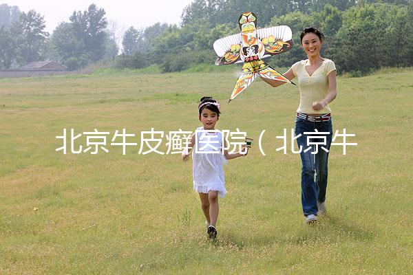 北京牛皮癬醫院（北京牛皮癬醫院排名）