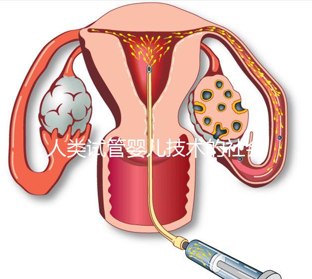 人類試管嬰兒技術(shù)的社會(huì)價(jià)值