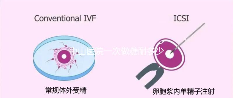 中山醫(yī)院一次做糖耐多少錢？你想預(yù)約專家嗎？