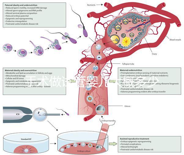 手術(shù)做試管嬰兒大概多少錢(手術(shù)做試管嬰兒大概多少錢啊)