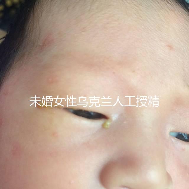 未婚女性烏克蘭人工授精必看!醫(yī)療及生活費用明細(xì)預(yù)覽