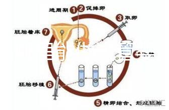 文昌哪里能做試管嬰兒？國(guó)內(nèi)做一次成功率有多高？