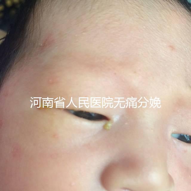 河南省人民醫(yī)院無痛分娩多少錢戳,收費標準60s看懂不踩坑