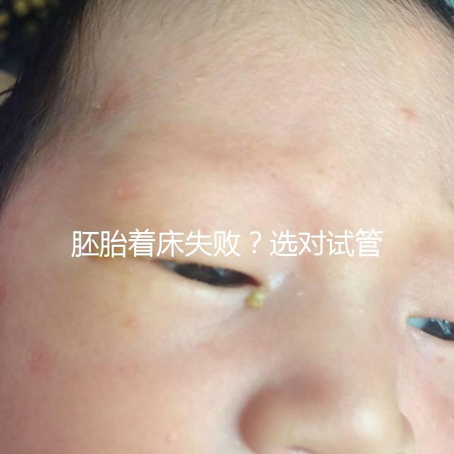 胚胎著床失敗?選對試管嬰兒醫(yī)生很重要