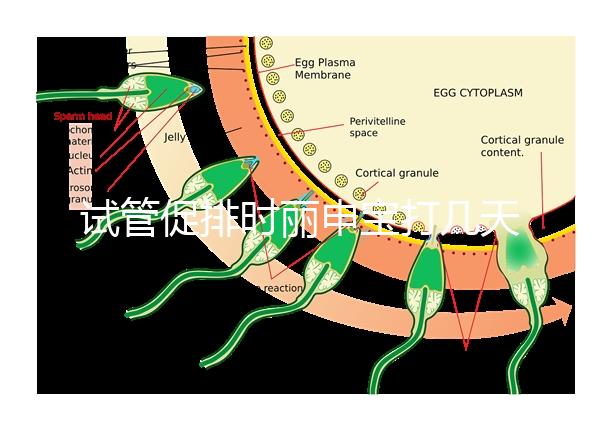 試管促排時(shí)麗申寶打幾天?我們來看看網(wǎng)友們的回答