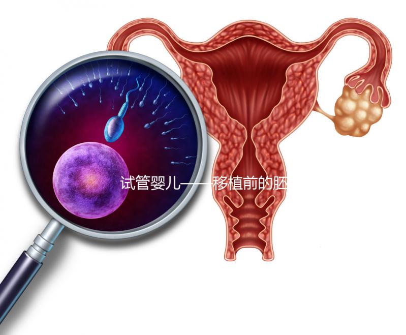 試管嬰兒——移植前的胚胎選擇!