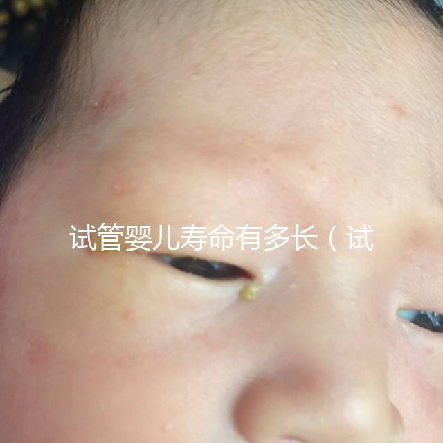 試管嬰兒壽命有多長(zhǎng)(試管嬰兒壽命有多長(zhǎng)時(shí)間)