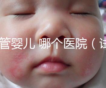 試管嬰兒 哪個(gè)醫(yī)院（試管嬰兒哪個(gè)醫(yī)院做的最好）