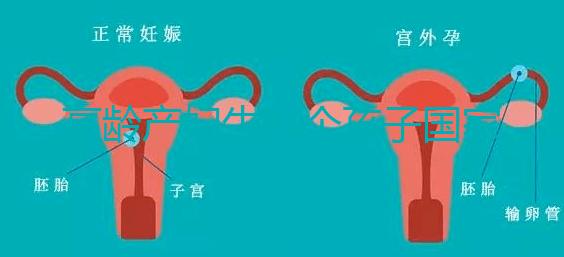 高齡產婦生八個孩子國家有補助？有沒有違法才是關鍵