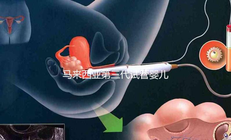 馬來西亞第三代試管嬰兒限時優惠套餐12萬元人民幣
