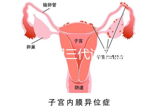 2025昆明三代試管助孕費用一覽，8-15萬元，價格透明公開自主選擇